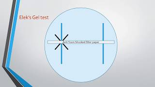 Diphtheria and Elek’s Gel Precipitation test [upl. by Charlena]