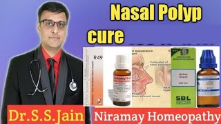 Nasal Polyps  causes symptoms Homeopathic medicine  how to cure naturally [upl. by Retsel]