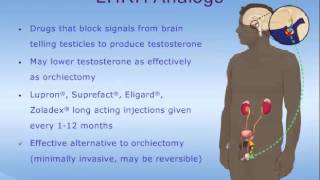 Hormone Therapy for Prostate Cancer [upl. by Crutcher31]