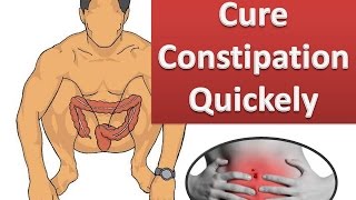 How to Relieve Constipation Quickly amp Naturally [upl. by Nuahsyd]