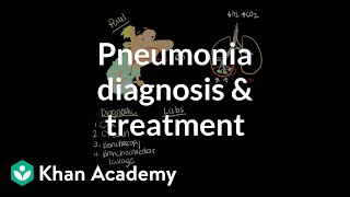 Pneumonia diagnosis and treatment  Respiratory system diseases  NCLEXRN  Khan Academy [upl. by Zannini420]