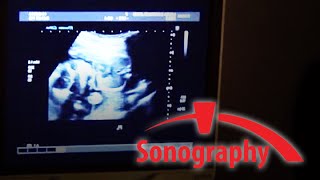 SONO – Sonography  BRCC [upl. by Ahsat]