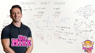 Ischemic Heart Disease Coronary Artery Disease [upl. by Derry]