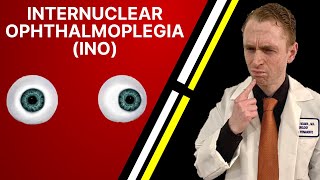 Neurologist Explains Internuclear Ophthalmoplegia INO [upl. by Yltneb825]