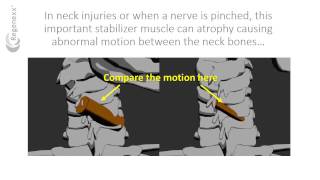 What is the multifidus function [upl. by Sidnala]