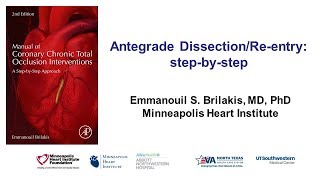 Antegrade dissection and reentry stepbystep [upl. by Aissatan773]