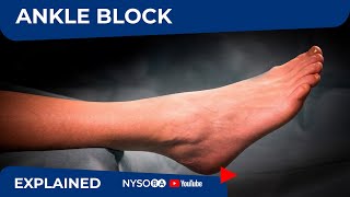 Regional Anesthesia UltrasoundGuided Ankle Block [upl. by Atinor850]