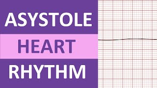 Asystole Heart Rhythm ECG Causes Treatment Nursing NCLEX Review EKG Flatline [upl. by Ssepmet]