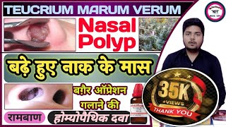 NASAL POLYP Treatment  Teucrium Marum Verum  नाक के मास को गलाने की अचूक दवा  Ascarides Worms [upl. by Albers]