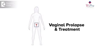 Vaginal Prolapse Treatment  Dr Sahana K P [upl. by Ceciley]