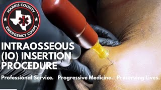 Intraosseous IO Insertion Procedure [upl. by Susan]