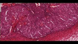 Histology of the Corpus Luteum 4K [upl. by Nylrad]