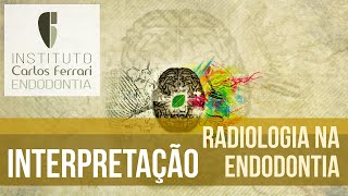 Radiologia na endodontia  3a aula Interpretação [upl. by Leroj]