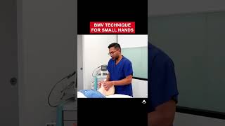 BMV Technique for Small Hands  anesthesia bagmaskventilation airway [upl. by Lowry]