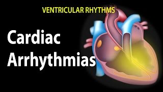 Cardiac Arrhythmias Animation [upl. by Kast]