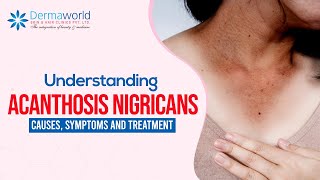 Understanding Acanthosis Nigricans Causes Symptoms and Treatment [upl. by Ycats]