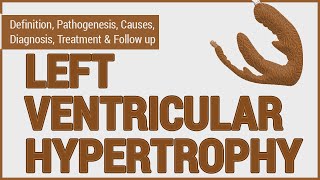 Left Ventricular Hypertrophy LVH  What is LVH and how is it diagnosed amp managed [upl. by Nelie]