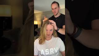 double hairline warning hair hairtransformation hairroutine rosemaryoil haircare hairgrowth [upl. by Sylvia100]