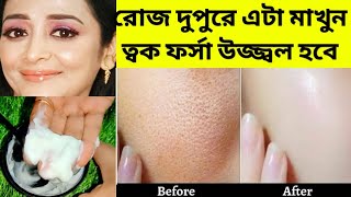 রোজ দুপুরে এটা মাখুন ত্বক ফর্সা উজ্জ্বল হবেforsa hobar tipsSkin Whitening Facial Glowing Skin [upl. by Gnuh]