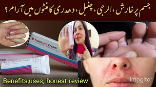 Travocort cream uses  benefits honest review by Maha jutt [upl. by Whiting]