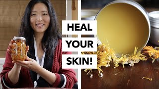 How to Use Calendula to Heal Skin 3 Different Ways [upl. by Lily407]