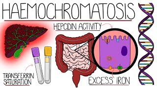 Understanding Haemochromatosis Hereditary amp Secondary [upl. by Llohcin]