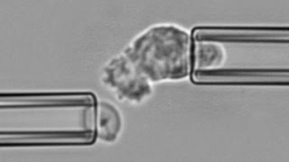 Chemotaxis and phagocytosis by a neutrophil encountering zymosan [upl. by Akinajnat]