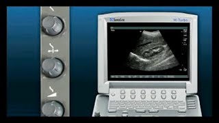 Basics of Ultrasonography [upl. by Anifares]