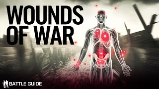 Wounded on The Western Front  A Death Sentence WW1 Documentary [upl. by Israeli]