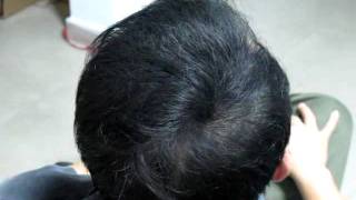 How to Thicken Hair Naturally [upl. by Pape]