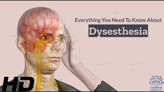 Dysesthesia 101 A Comprehensive Guide to this Mysterious Condition [upl. by Selrahc]