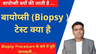 What is Biopsy test in Hindi  Test for Cancer बायोप्सी के बारे में जानकारी [upl. by Soane]