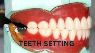 Arrangement of Maxillary amp Mandibular Teeth Setting [upl. by Ynez]