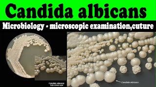 Candida albicans microbiology  microscopic examinationcuturelaboratory diagnosis [upl. by Aitahs]