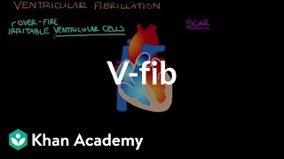 What is ventricle fibrillation Vfib  Circulatory System and Disease  NCLEXRN  Khan Academy [upl. by Idas686]