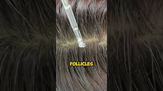 Hair Loss This Blood Test Is the 1 Thing You’re Missing [upl. by Edrei]