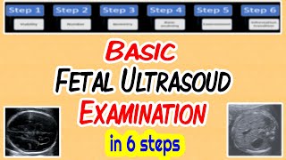 Basic Fetal Ultrasound Examination [upl. by Nylecsoj]