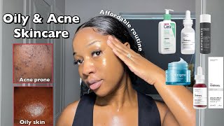 SKINCARE ROUTINE FOR OILY ACNEPRONE SKIN  A routine for smooth amp clear Skin ‼️ [upl. by Otrebcire]