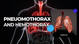 Pneumothorax and Hemothorax  Types amp Management [upl. by Roskes]