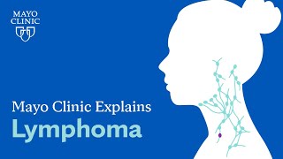 Mayo Clinic Explains Lymphoma [upl. by Ahsiyk]