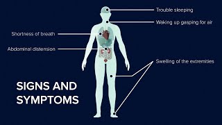 What is Heart Failure Causes Symptoms and Treatment [upl. by Artsa]