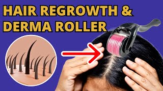 How Does the Derma Roller Help with Hair Regrowth [upl. by Ttimme]