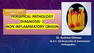 Periapical Pathology  Non inflammatory and non odontogenic lesions [upl. by Itin]