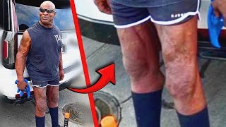 WTF Happened to Ronnie Colemans Legs [upl. by Emia]