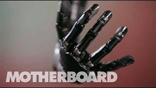 The MindControlled Bionic Arm With a Sense of Touch [upl. by Oinoitna]