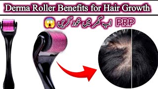 Derma roller 1mm for Hair RegrowthHow to use derma roller for hair growth [upl. by Shifra]