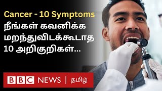 Cancer 10 Symptoms இதை சீக்கிரம் கவனிச்சிட்டா Treatment மூலம் குணப்படுத்திவிடலாம் [upl. by Eem]