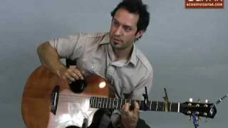 Acoustic Guitar Lesson with Trace Bundy [upl. by Sorenson]