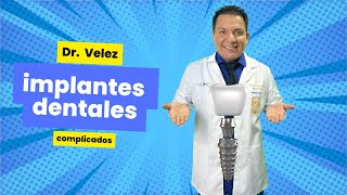 ✅ Implantes Dentales Complicados  CLINICA DENTAL VELEZ [upl. by Elleivap]