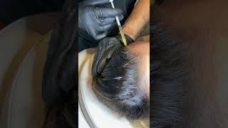 Struggling with hair thinning or hair loss [upl. by Risser]